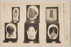 癩病三種/Three Types of Leprosy image