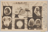 結核/Tuberculosis image